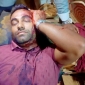 নোয়াখালীতে বাকবিতন্ডায় মাথা ফাটালো ছাত্রদল নেতার